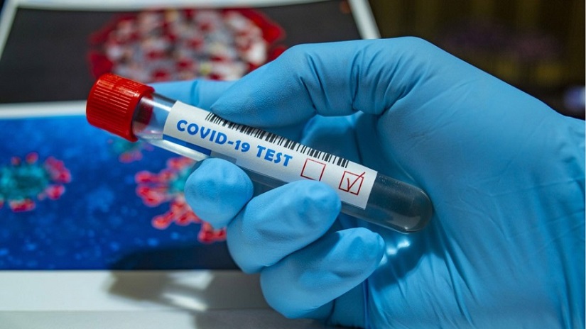 एक सातामा ३५ जनामा कोरोना संक्रमण